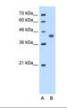 PDHA1 / PDH E1 Alpha Antibody - Lane A: Marker. Lane B: HepG2 cell lysate. Antibody concentration: 5.0 ug/ml. Gel concentration: 12%.  This image was taken for the unconjugated form of this product. Other forms have not been tested.