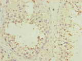 PDHA2 / PDH E1 Beta Antibody - Immunohistochemistry of paraffin-embedded human testis tissue at dilution of 1:100