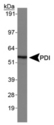 PDIA2 Antibody - PDI Antibody - Western Blot on normal human brain.