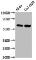 PDILT Antibody - Western Blot Positive WB detected in: A549 whole cell lysate, Colo320 whole cell lysate All Lanes: PDILT antibody at 4.63µg/ml Secondary Goat polyclonal to rabbit IgG at 1/50000 dilution Predicted band size: 67 KDa Observed band size: 67 KDa