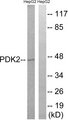 PDK2 Antibody - Western blot analysis of lysates from HepG2 cells, using PDK2 Antibody. The lane on the right is blocked with the synthesized peptide.