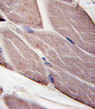 PDK4 Antibody - Formalin-fixed and paraffin-embedded human skeletal muscle tissue reacted with PDK4-E265, which was peroxidase-conjugated to the secondary antibody, followed by DAB staining. This data demonstrates the use of this antibody for immunohistochemistry; clinical relevance has not been evaluated.