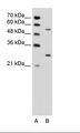 PDPK1 / PDK1 Antibody - A: Marker, B: Jurkat Cell Lysate.  This image was taken for the unconjugated form of this product. Other forms have not been tested.