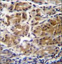PDPR Antibody - PDPR Antibody immunohistochemistry of formalin-fixed and paraffin-embedded human stomach tissue followed by peroxidase-conjugated secondary antibody and DAB staining.