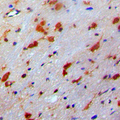 PDRG1 Antibody - Immunohistochemical analysis of PDRG1 staining in human brain formalin fixed paraffin embedded tissue section. The section was pre-treated using heat mediated antigen retrieval with sodium citrate buffer (pH 6.0). The section was then incubated with the antibody at room temperature and detected using an HRP conjugated compact polymer system. DAB was used as the chromogen. The section was then counterstained with hematoxylin and mounted with DPX.