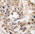 PDX1 Antibody - Formalin-fixed and paraffin-embedded human testis tissue reacted with PDX1 Antibody , which was peroxidase-conjugated to the secondary antibody, followed by DAB staining. This data demonstrates the use of this antibody for immunohistochemistry; clinical relevance has not been evaluated.