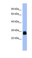 PDX1 Antibody - PDX1 antibody Western blot of PANC1 cell lysate. This image was taken for the unconjugated form of this product. Other forms have not been tested.