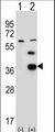 PDXK / PNK Antibody - Western blot of PDXK (arrow) using rabbit polyclonal PDXK Antibody (H13). 293 cell lysates (2 ug/lane) either nontransfected (Lane 1) or transiently transfected (Lane 2) with the PDXK gene.