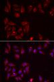 PDXK / PNK Antibody - Immunofluorescence analysis of U2OS cells.