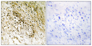 PDZD2 Antibody - Immunohistochemistry analysis of paraffin-embedded human heart tissue, using PDZD2 Antibody. The picture on the right is blocked with the synthesized peptide.