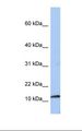 PEA15 / PEA-15 Antibody - 721_B cell lysate. Antibody concentration: 1.0 ug/ml. Gel concentration: 10-20%.  This image was taken for the unconjugated form of this product. Other forms have not been tested.