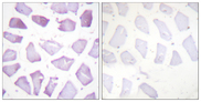 PEA15 / PEA-15 Antibody - Immunohistochemistry analysis of paraffin-embedded human skeletal muscle, using PEA-15 (Phospho-Ser116) Antibody. The picture on the right is blocked with the phospho peptide.