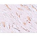 PEAR1 Antibody - Immunohistochemistry of PEAR1 in human kidney tissue with PEAR1 antibody at 2.5 µg/mL.