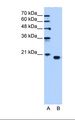 PEBP1 / RKIP Antibody - Lane A: Marker. Lane B: HepG2 cell lysate. Antibody concentration: 1.25 ug/ml. Gel concentration: 15%.  This image was taken for the unconjugated form of this product. Other forms have not been tested.