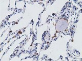 PECR Antibody - IHC of paraffin-embedded Human lung tissue using anti-PECR mouse monoclonal antibody. (Dilution 1:50).