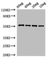 Penicillin-binding protein 4 Antibody - Positive WB detected in Recombinant protein;All lanes:pbpE antibody at 3?g/ml;Secondary;Goat polyclonal to rabbit IgG at 1/50000 dilution;Predicted band size: 52 KDa;Observed band size: 52 KDa;