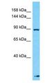 PER1 Antibody - PER / PER1 antibody Western Blot of Fetal Liver. Antibody dilution: 1 ug/ml.  This image was taken for the unconjugated form of this product. Other forms have not been tested.