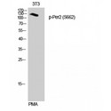 PER2 Antibody - Western blot of Phospho-Per2 (S662) antibody