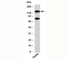 PER2 Antibody - PER2 Antibody western blot of human samples