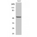 Peripherin Antibody - Western blot of PRPH antibody