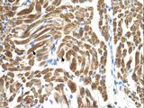 PEX10 Antibody - PEX10 antibody PEX10(peroxisome biogenesis factor 10) Antibody was used in IHC to stain formalin-fixed, paraffin-embedded human muscle.  This image was taken for the unconjugated form of this product. Other forms have not been tested.