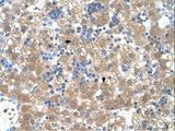 PEX3 Antibody - PEX3 antibody PEX3(peroxisomal biogenesis factor 3) Antibody was used in IHC to stain formalin-fixed, paraffin-embedded human liver.  This image was taken for the unconjugated form of this product. Other forms have not been tested.