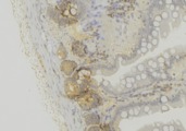 PEX6 Antibody - 1:100 staining mouse colon tissue by IHC-P. The sample was formaldehyde fixed and a heat mediated antigen retrieval step in citrate buffer was performed. The sample was then blocked and incubated with the antibody for 1.5 hours at 22°C. An HRP conjugated goat anti-rabbit antibody was used as the secondary.
