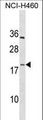 PF4V1 Antibody - PF4V1 Antibody western blot of NCI-H460 cell line lysates (35 ug/lane). The PF4V1 antibody detected the PF4V1 protein (arrow).