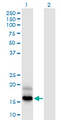 PFDN4 Antibody - Western Blot analysis of PFDN4 expression in transfected 293T cell line by PFDN4 monoclonal antibody (M03), clone 2G4.Lane 1: PFDN4 transfected lysate (Predicted MW: 14.85 KDa).Lane 2: Non-transfected lysate.
