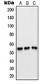 PFKFB1+4 Antibody - Western blot analysis of PFKFB1/4 expression in Jurkat (A); H1299 (B); HeLa (C) whole cell lysates.