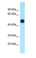 PFTK1 / CDK14 Antibody - PFTK1 / CDK14 antibody Western Blot of Mouse Pancreas.  This image was taken for the unconjugated form of this product. Other forms have not been tested.