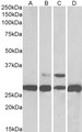 Antibody - Goat Anti-PGAM1 / PGAM2 / PGAM4 Antibody (0.05µg/ml) staining of Human (A), Mouse (B), Rat (C) and Pig Liver (D) lysates (35µg protein in RIPA buffer). Primary incubation was 1 hour. Detected by chemiluminescencence.