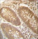 PGAM4 Antibody - PGAM4 Antibody immunohistochemistry of formalin-fixed and paraffin-embedded human colon tissue followed by peroxidase-conjugated secondary antibody and DAB staining.