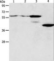 PGBD2 Antibody - Western blot analysis of A375 and A172 cell, mouse pancreas tissue, human liver cancer tissue, using PGBD2 Polyclonal Antibody at dilution of 1:550.