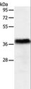 PGBD2 Antibody - Western blot analysis of Human liver cancer tissue, using PGBD2 Polyclonal Antibody at dilution of 1:550.