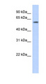 PGBD3 Antibody - PGBD3 antibody Western blot of Transfected 293T cell lysate. This image was taken for the unconjugated form of this product. Other forms have not been tested.
