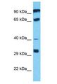 PGBD4 Antibody - PGBD4 antibody Western Blot of Jurkat. Antibody dilution: 1 ug/ml.  This image was taken for the unconjugated form of this product. Other forms have not been tested.