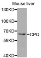 PGCP / Aminopeptidase Antibody - Western blot analysis of extracts of mouse liver cells.