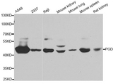 PGD Antibody - Western blot analysis of extracts of various cell lines.