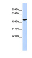 PGIS / PTGIS Antibody - PTGIS antibody Western blot of Fetal Brain lysate. This image was taken for the unconjugated form of this product. Other forms have not been tested.