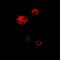 PGK1 / Phosphoglycerate Kinase Antibody - Immunofluorescent analysis of PGK1 staining in HeLa cells. Formalin-fixed cells were permeabilized with 0.1% Triton X-100 in TBS for 5-10 minutes and blocked with 3% BSA-PBS for 30 minutes at room temperature. Cells were probed with the primary antibody in 3% BSA-PBS and incubated overnight at 4 deg C in a humidified chamber. Cells were washed with PBST and incubated with a DyLight 594-conjugated secondary antibody (red) in PBS at room temperature in the dark.