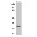 PGLS / 6PGL Antibody - Western blot of PGLS antibody