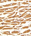 PGM1 / Phosphoglucomutase 1 Antibody - Antibody staining PGM1 in human heart tissue sections by Immunohistochemistry (IHC-P - paraformaldehyde-fixed, paraffin-embedded sections). Tissue was fixed with formaldehyde and blocked with 3% BSA for 0. 5 hour at room temperature; antigen retrieval was by heat mediation with a citrate buffer (pH 6). Samples were incubated with primary antibody (1/25) for 1 hours at 37°C. A undiluted biotinylated goat polyvalent antibody was used as the secondary antibody.