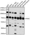 PGM2 Antibody - Western blot analysis of extracts of various cell lines, using PGM2 antibody at 1:1000 dilution. The secondary antibody used was an HRP Goat Anti-Rabbit IgG (H+L) at 1:10000 dilution. Lysates were loaded 25ug per lane and 3% nonfat dry milk in TBST was used for blocking. An ECL Kit was used for detection and the exposure time was 10s.