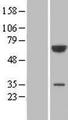 PGM3 Protein - Western validation with an anti-DDK antibody * L: Control HEK293 lysate R: Over-expression lysate
