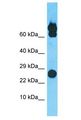 PGPEP1L Antibody - PGPEP1L antibody Western Blot of COLO205. Antibody dilution: 1 ug/ml.  This image was taken for the unconjugated form of this product. Other forms have not been tested.
