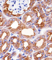 PH / PAH Antibody - Immunohistochemical of paraffin-embedded M. kidney section using PAH Antibody. Antibody was diluted at 1:25 dilution. A peroxidase-conjugated goat anti-rabbit IgG at 1:400 dilution was used as the secondary antibody, followed by DAB staining.