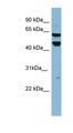 PH4 / P4HTM Antibody - P4HTM antibody Western blot of HT1080 cell lysate. This image was taken for the unconjugated form of this product. Other forms have not been tested.