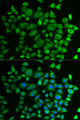 PH4 / P4HTM Antibody - Immunofluorescence analysis of HeLa cells.