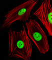 PHAP III / ANP32E Antibody - Fluorescent image of SH-SY5Y cells stained with ANP32E Antibody. Antibody was diluted at 1:25 dilution. An Alexa Fluor 488-conjugated goat anti-rabbit lgG at 1:400 dilution was used as the secondary antibody (green). Cytoplasmic actin was counterstained with Alexa Fluor 555 conjugated with Phalloidin (red).